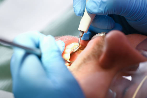 Best Weekend Emergency Dentist in Maumee, OH